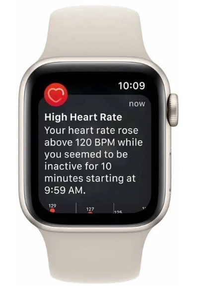 Умные часы Apple Watch SE 2 2023 40мм (сияющая звезда/сияющая звезда, S/M) Умные часы Apple Watch SE 2 2023 40мм (сияющая звезда/сияющая звезда, S/M)